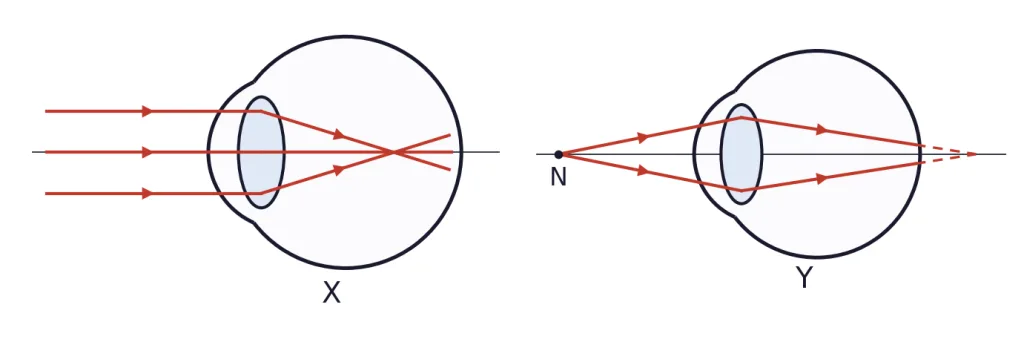 Two eyes X and Y with rays forming images, point N marked