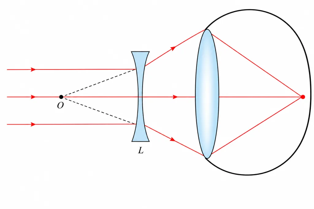 Concave lens in front of an eye, with rays and point O