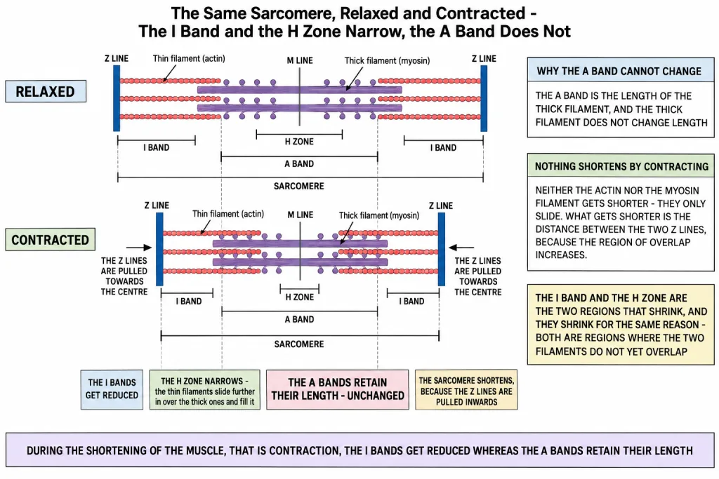 Sliding of thin filaments with the I band and H zone shrinking during contraction