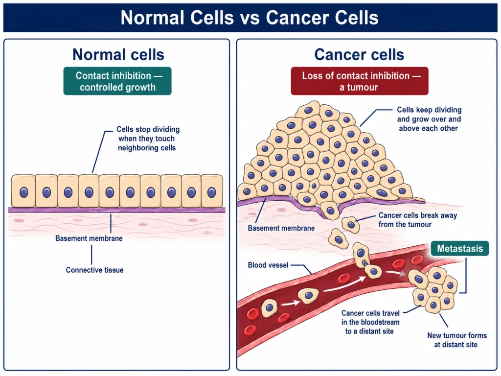 Normal cells showing contact inhibition compared with cancer cells dividing uncontrollably to form a tumour and spreading by metastasis